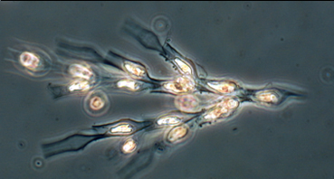 Kasviplankton2.jpg